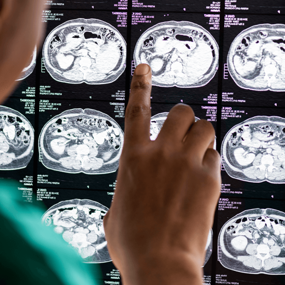 supervision_recherche